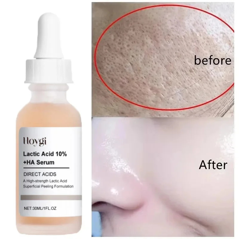 Licorice Root Extract - Laktik Asit Gözenekleri Küçültmek Serum Hızlı