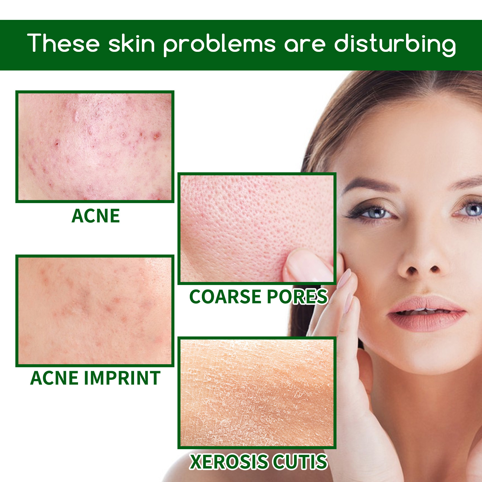 Salisilik Asit Anti Acn-e Yüz  - Glycolic Acid Exfoliant incelemesi ve fiyatı