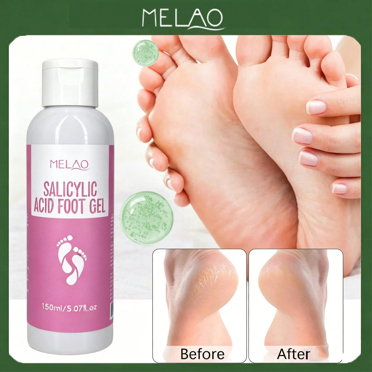 MELAO Salisilik Asit Ayak Jeli - Glycolic Acid Exfoliant incelemesi ve fiyatı