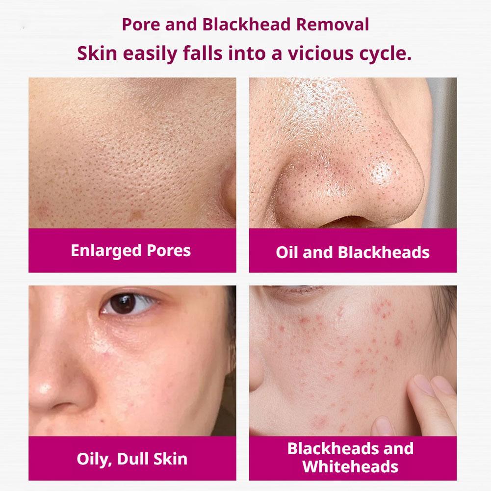 Salisilik Asit Gözenekleri Sık - Glycolic Acid Exfoliant incelemesi ve fiyatı