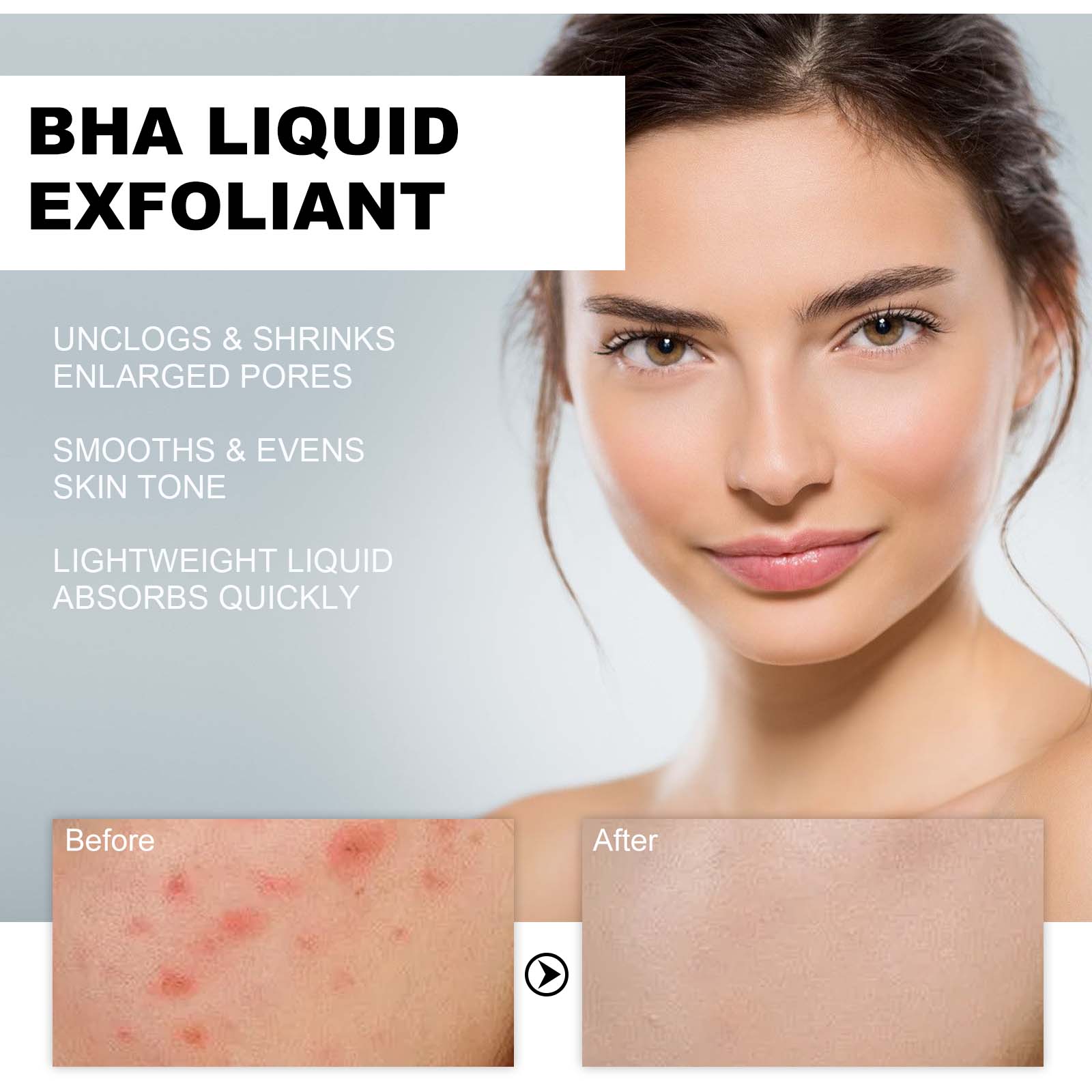 %2 Salisilik Asit Sıvı Eksfoli - Glycolic Acid Exfoliant incelemesi ve fiyatı