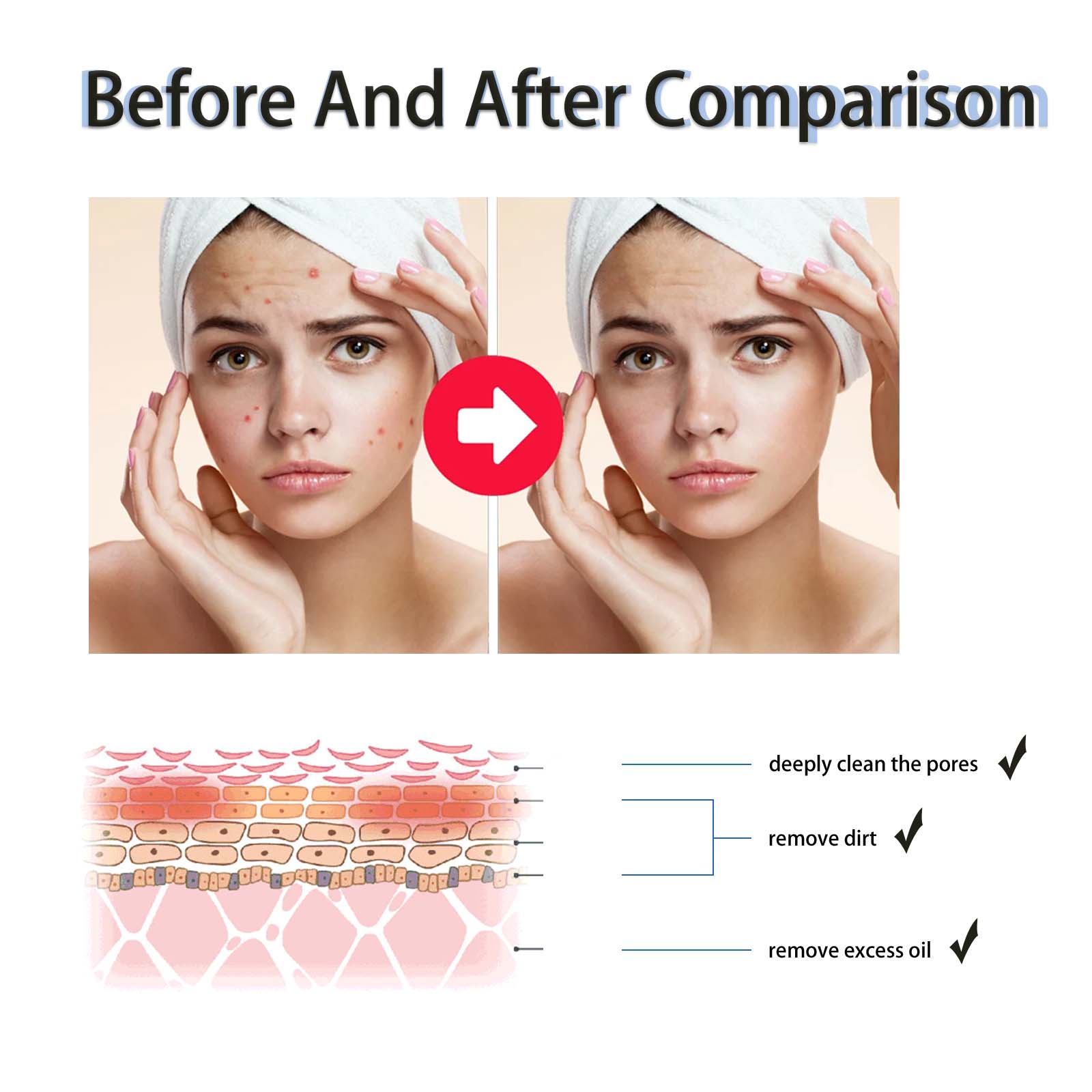 %2 Salisilik Asit Sıvı Eksfoli - Glycolic Acid Exfoliant incelemesi ve fiyatı