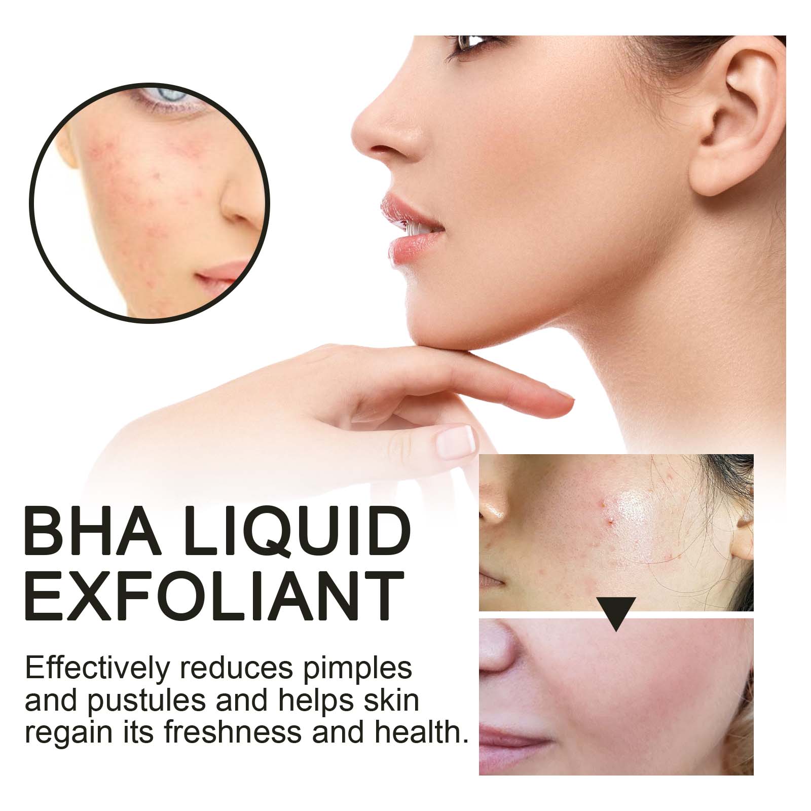 %2 Salisilik Asit Sıvı Eksfoli - Glycolic Acid Exfoliant incelemesi ve fiyatı