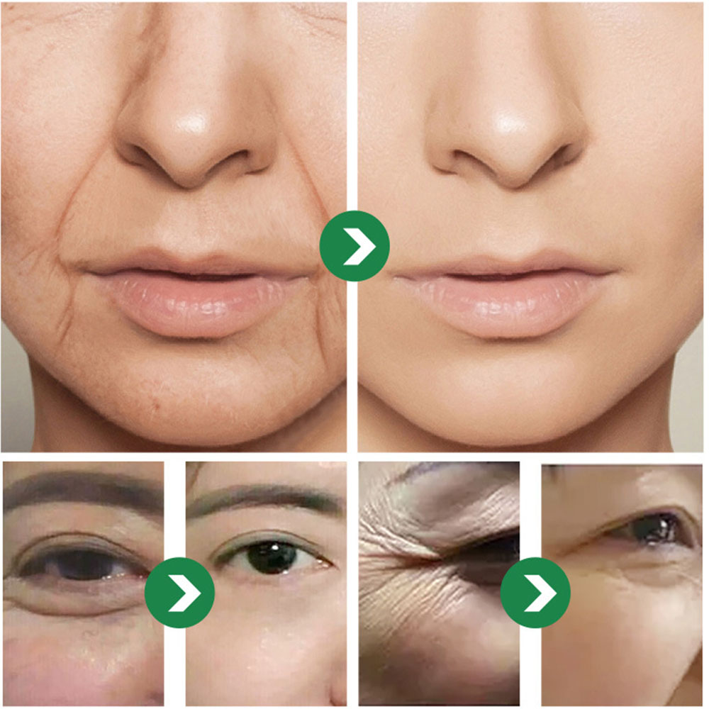 50g Japon Altı Peptitli Krem K - Eye Cream Peptide incelemesi ve fiyatı