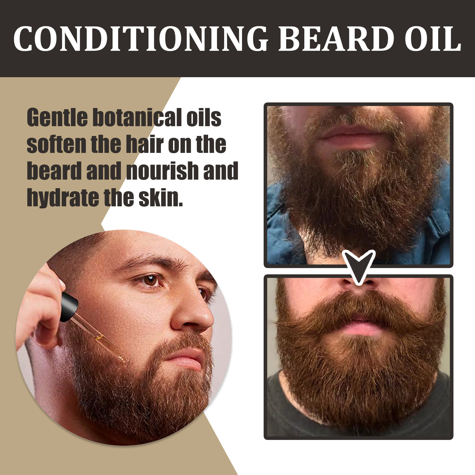 30ml Yüz Sakalı Büyüme Yağı Se - Tea Tree Spot Treatment incelemesi ve fiyatı